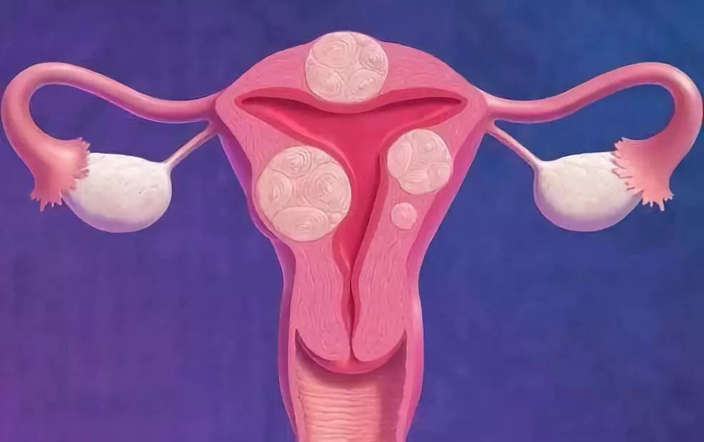 孕妇降血糖菜谱